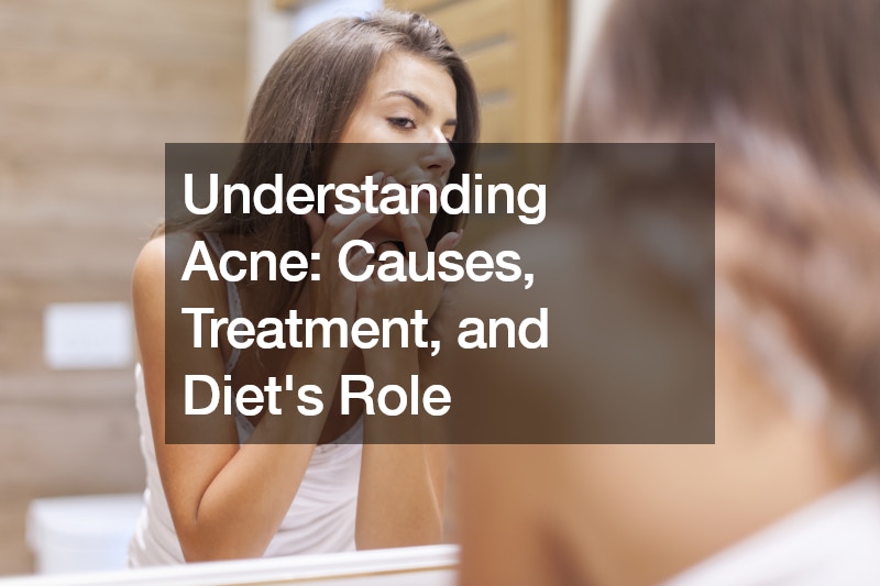 Understanding Acne Causes, Treatment, and Diets Role